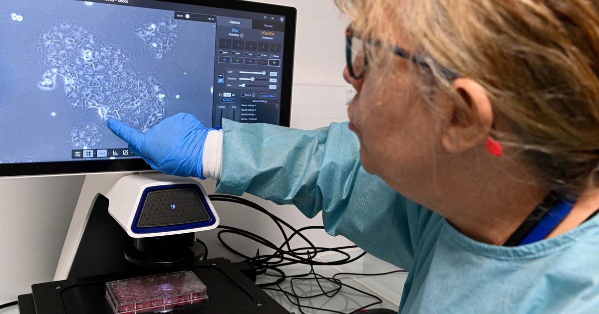 Experimental pill helps people with advanced pancreatic cancer live longer, researchers say