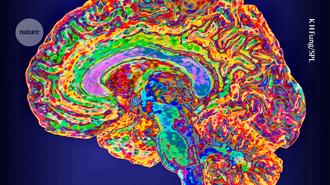 A mind-reading brain implant that comes with password protection