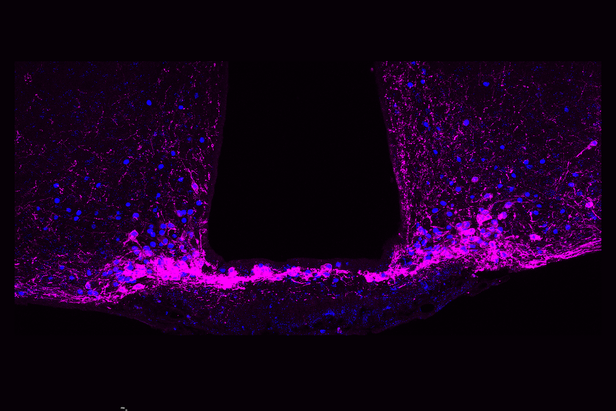 A built-in ‘off switch’ to stop persistent pain