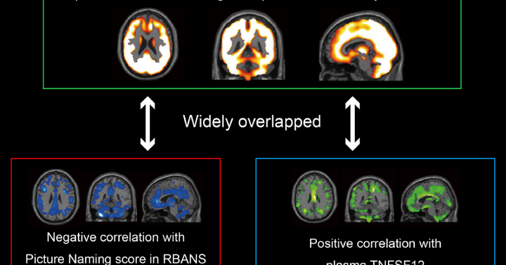 Uncovering the Molecular Basis of Long COVID Brain Fog | Yokohama City University