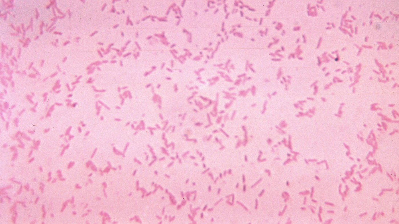 Study: We're losing the war against drug-resistant infections faster than we thought